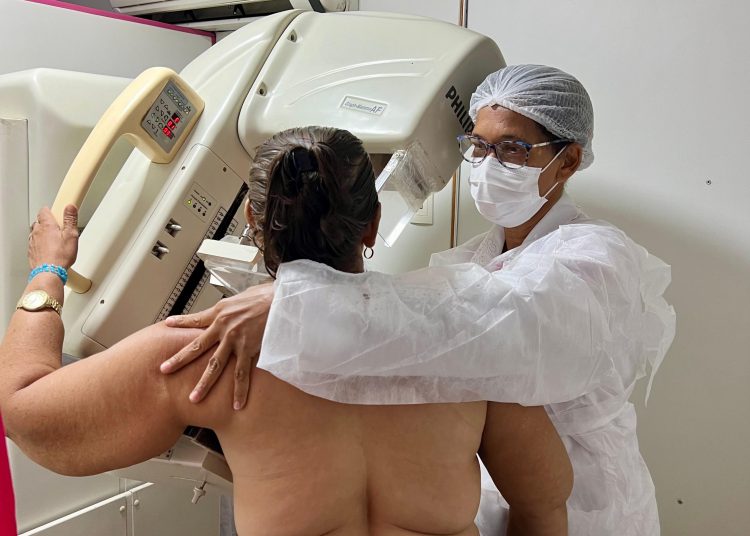 Prefeitura e Estado iniciam Mutirão de Mamografia para mulheres de 50 a 69 anos e ação prevê mais de dois mil atendimentos até 2 de maio