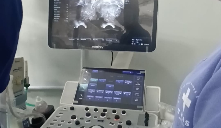 Hospital Nair Alves de Souza realiza primeira Ultrassonografia Transfontanela à beira-leito na UCI Neonatal