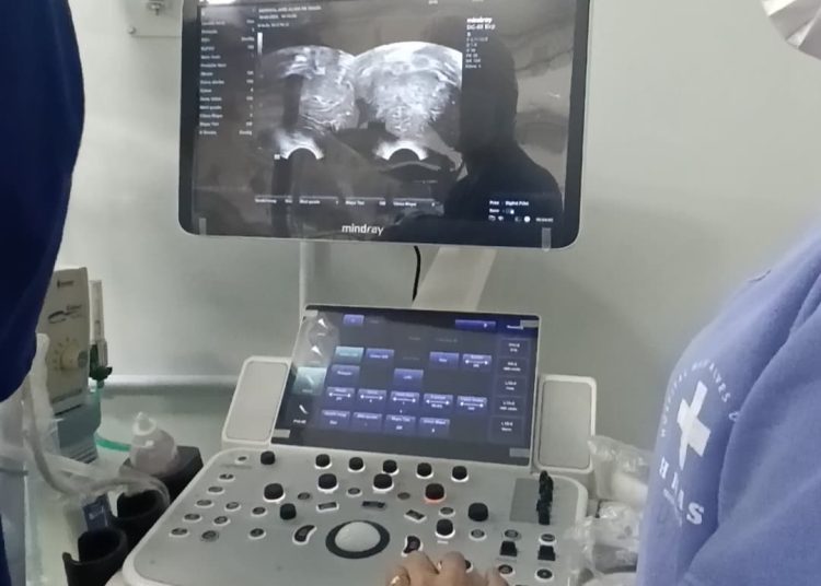7065d5e0ea9647ae95891667b8e1f312 Prefeitura de Paulo Afonso Hospital Nair Alves de Souza realiza primeira Ultrassonografia Transfontanela à beira-leito na UCI Neonatal